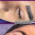 کلینیک لیزر و زیبایی دایان