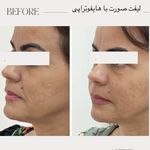 مرکز لیزر ،پوست و زیبایی کندی بیوتی