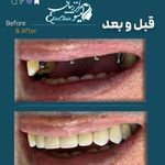 کلینیک دندان پزشکی و ایمپلنت الیسو