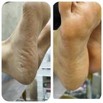 پدیکور و کفسابی پا