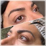 میکروبلیدینگ میکروپیگمنیشن و ریمو گلنسا