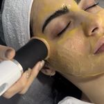 فیشال الا اسکین