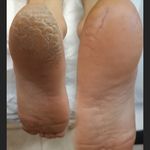 کفسابی و پدولوژی ناخن خانمها و آقایان