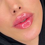 کلینیک پوست وزیبایی ومرکز تخصصی فیلربادی
