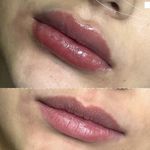 کلینیک زیبایی الماس کاملا اقساطی
