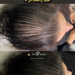 اولین مرکز اسکراپ و میکرواسکالپ در مشهد