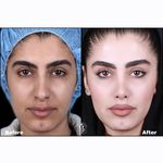 دکتر بهروز جلالی (جراحی بینی لیفت صورت)