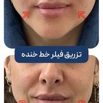 کلینیک زیبایی و جوانسازی پوست و مو الین