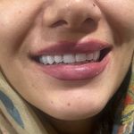 دندانسازی حسن پور جوان