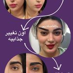 کلینیک لیزر و زیبایی دایان