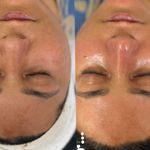 مژگان اسکین کرMojgan skincare