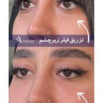 مجموعه زیبایی آتیماه