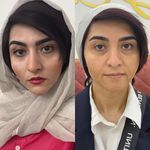 کلینیک پوست و زیبایی ولاغری تاج عظیمیه