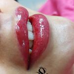 مرکز تخصصی میکروبلیدینگ فیبروز ریموو تخصصی
