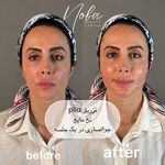 کلینیک زیبایی و لیزر مو زائد نوبا