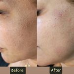 فیشال تخصصی و درمانی ونوس اسکینکر