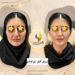 کلینیک زیبایی و مرکز لیزر هانیسا