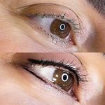 هدا ایزدی ؛ میکرو تخصصی صورت اصفهان