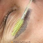 میکروکیماسی( میکروابرو چشم لب،ریمو)