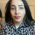 کلینیک زیبایی و لیزر لوتوس