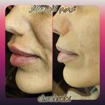 مطب پوست ،مو و لیزر یسنا طب