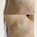 کفسابی و پدولوژی ناخن خانمها و آقایان