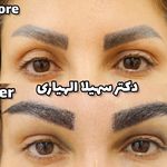کلینیک تخصصی کاشت موی پرنیان