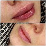 تزریقات و پانسمان و زیبایی آوینا - کاشان - 7074
