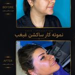 کلینیک تخصصی زیبایی و لیزر موی ابریشم