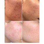 کلینیک فیشال و ماساژ سارن اسکین سارا