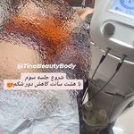 مشاور تغذیه و لاغری موضعی