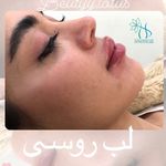 کلینیک پوست و مو و لیزر نیلوفر آبی