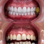 دندانپزشکی دکتر قاسم نژاد *بیمه نداریم*