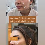 کلینیک لیزر و  زیبایی ملیح