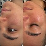 فیشال و خدمات پاکسازی پوست  فاطمه انامی