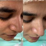 خدمات پاکسازی و فشیال پوست مهناز