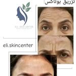 مطب زیبایی دکتر ملکی