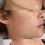 فیشال و اسکراپ اسکالپ عاطفه