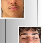 خدمات تخصصی فیشال و پاکسازی پوست صبا