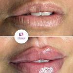 کلینیک تخصصی تزریق بادی نیلورا