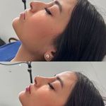 کلینیک پوست و زیبایی ژیلاوَش