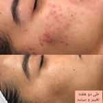 آموزش و خدمات پوست و فیشال رویا باقریان