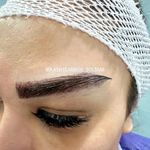 کاشت ابرو سلطانی متد پنج زاویه