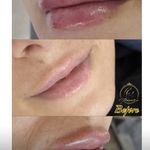 کلینیک زیبایی و پوست و مو رومنس