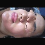 پاکسازی پوست میرزایی