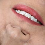 بهترین دندانپزشکی زیبایی، دکتر بهنیا