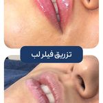 کلینیک زیبایی و جوانسازی پوست و مو الین