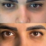 کلینیک لیزر  کندلاوزیبایی پوست ومو آیشیل