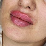 کلینیک زیبایی دکتر پژمان ا‌کبری