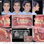 فتوگرافی پزشکی مظلومی